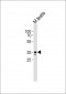 Mouse Ring1 Antibody (C-term)